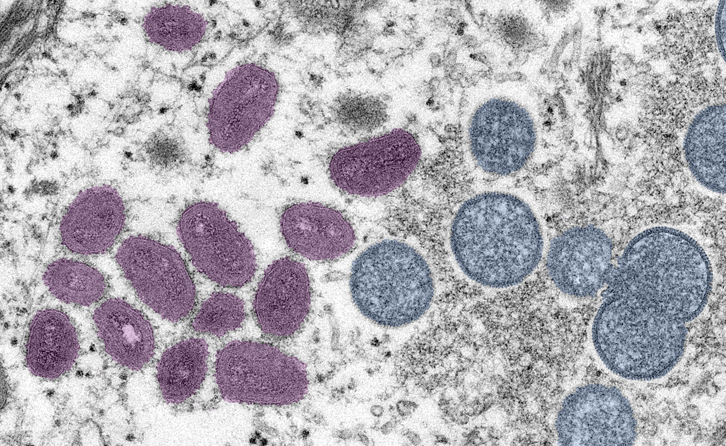 25793 Monkeypox Virus