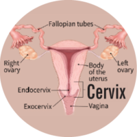 How is Cervical Cancer detected and what are the symptoms?