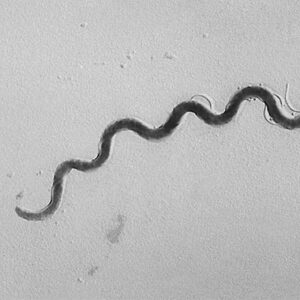 Laboratory Diagnosis of Syphilis Infection Remains a Challenge – Here’s Help