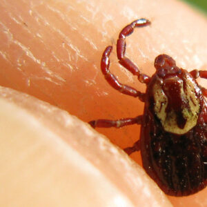 Locally Acquired Rocky Mountain Spotted Fever