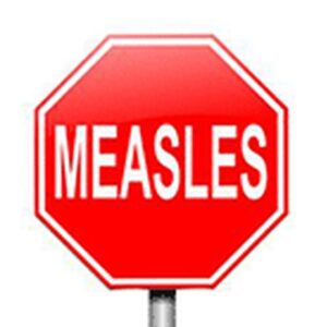 Know Your Measles Vaccination Status - How to Check Online